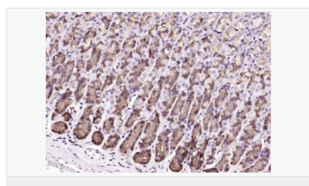 6052a76a3a916.png image.png