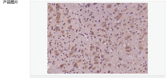 605854f906adc.png image.png