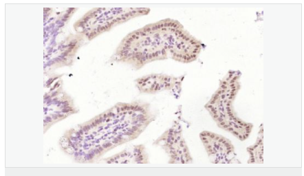 605acb1e16f5a.png image.png