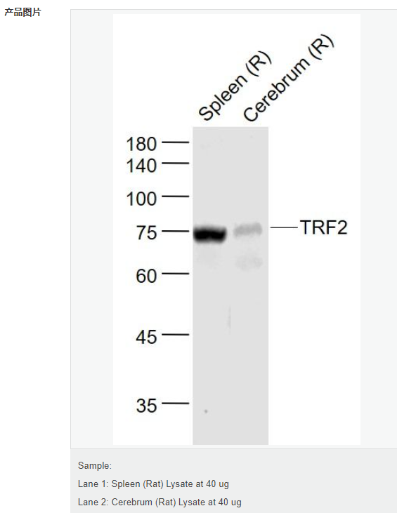 607d17cfb4210.png image.png